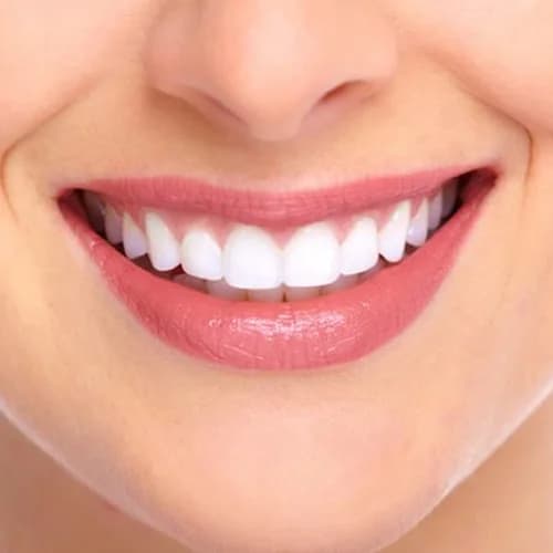 Aesthetic Tooth Luminescence & Whitening
